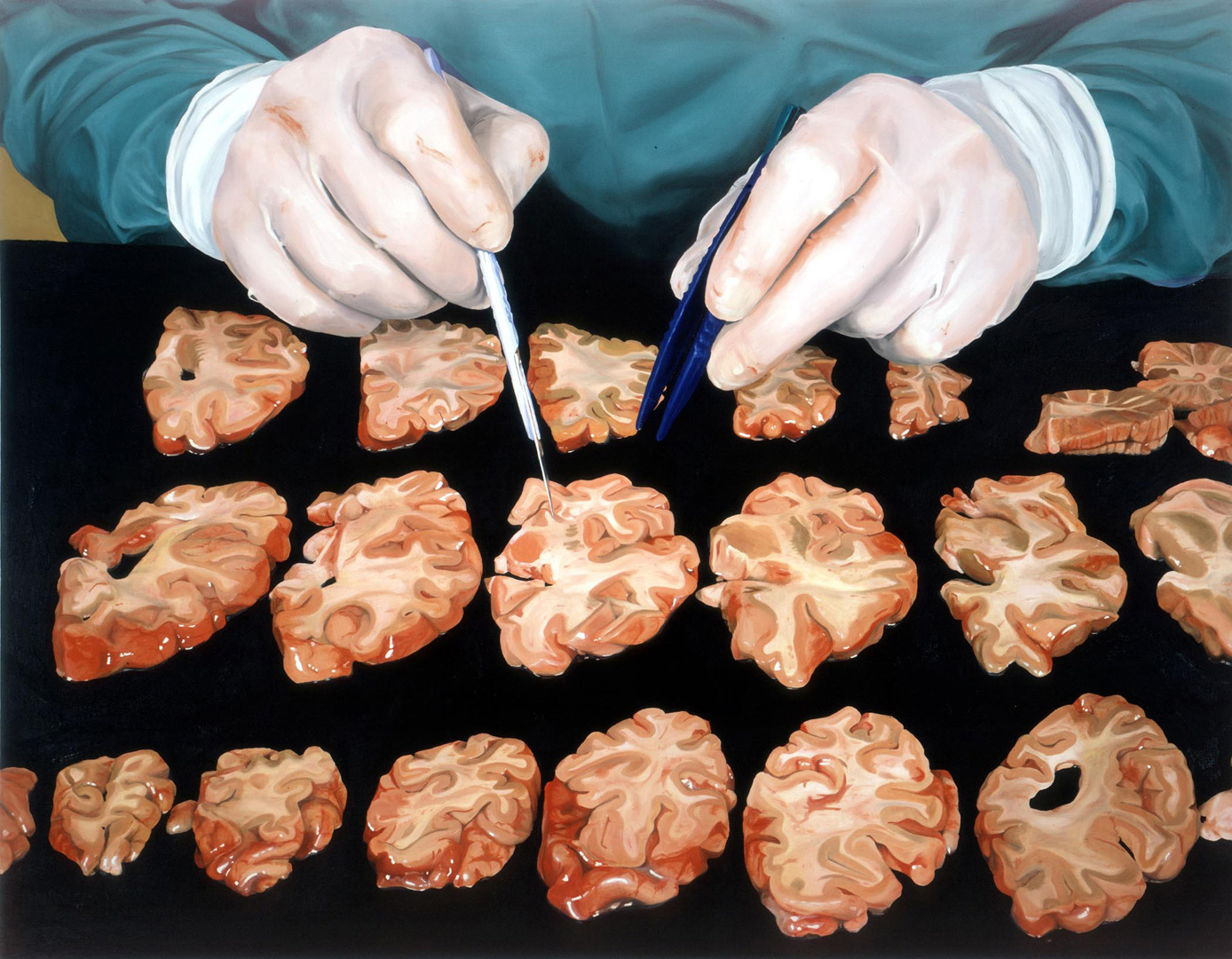 Damien Hirst - Autopsy with Sliced Human Brain, 2004, oil on canvas